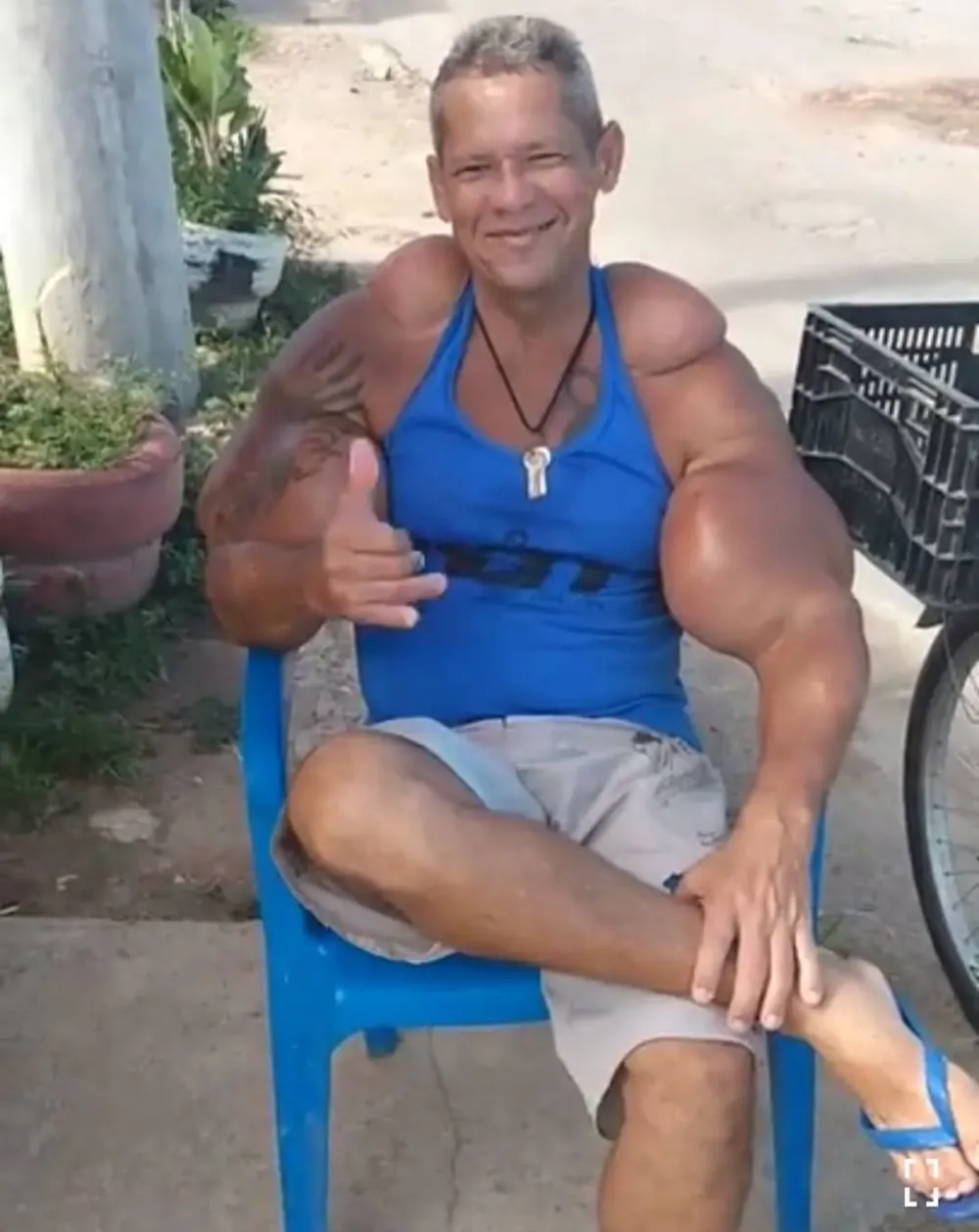 "Qu&aacute;i vật thể h&igrave;nh" Brazil sở hữu chu vi bắp tay l&ecirc;n tới 74cm đột ngột qua đời, b&aacute;c sĩ cảnh b&aacute;o 1 vấn đề sức khỏe tiềm ẩn- Ảnh 4.