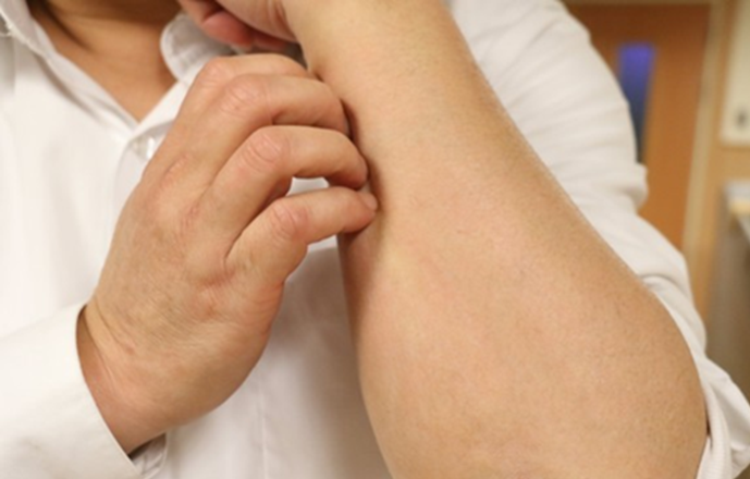 Suy thận giai đoạn cuối được phát hiện sau khi cơ thể có 1 triệu chứng vô hại, người đàn ông lên tiếng cảnh báo- Ảnh 1.