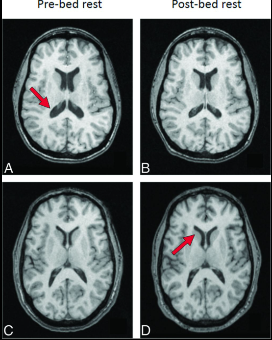 Não phi hành gia 'biến dạng' sau thời gian trên vũ trụ: Ảnh chụp hé lộ khác biệt này so với người thường - Ảnh 2.