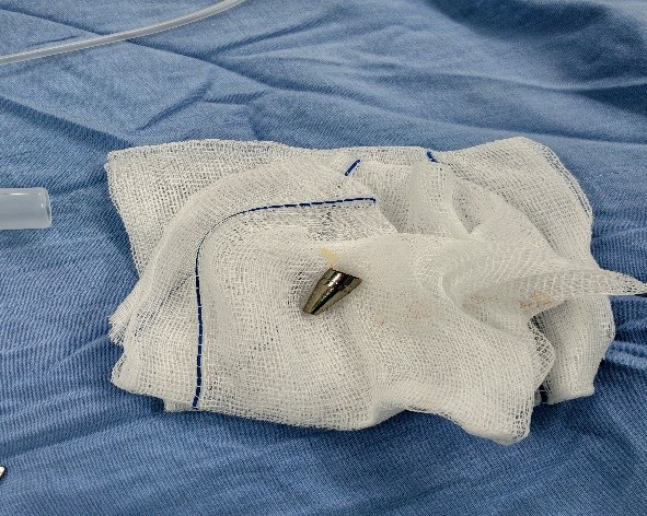 Ngậm Đầu Bút Trong Miệng, Một Học Sinh Ở Đà Nẵng Nhập Viện Cấp Cứu Dn Dau But 1769038070815 1769038071087762624367