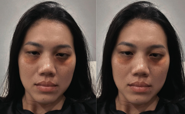 Dụi mắt kh&ocirc;ng nhận ra &Aacute;nh Vi&ecirc;n, sao lại ra n&ocirc;ng nỗi n&agrave;y?- Ảnh 1.