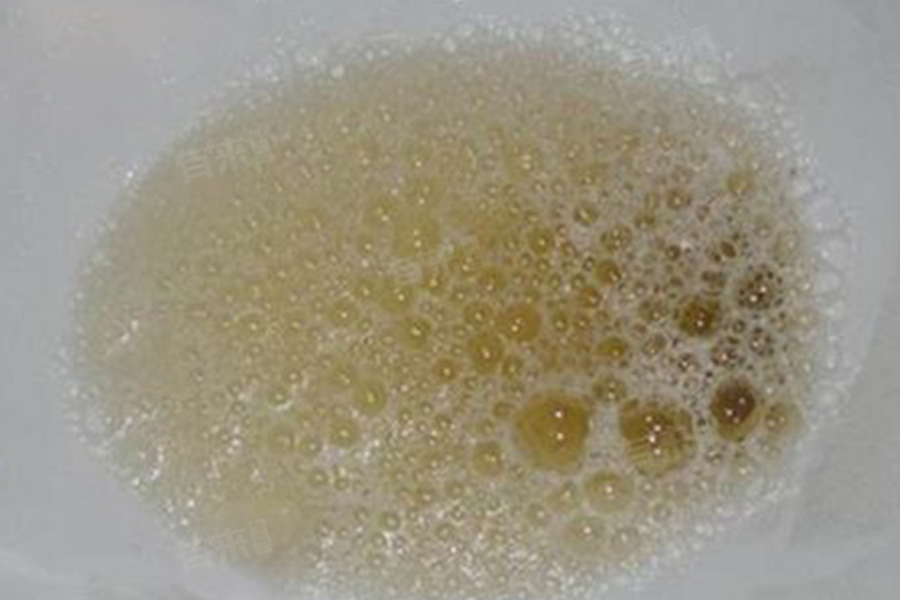 Thận Suýt “Hỏng Hoàn Toàn”, Người Đàn Ông 42 Tuổi Thầm Cảm Ơn Bản Thân Vì Chú Ý 1 Dấu Hiệu Nhiều Người Bỏ Qua- Ảnh 2.