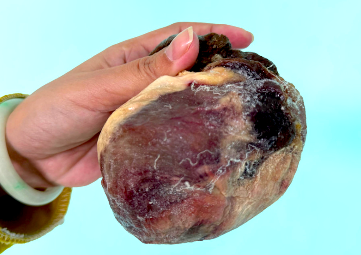 Mổ bò tiết lộ ngưu hoàng qúy hiếm , câu chuyện bất ngờ từ Gia Lai - Ảnh 1.