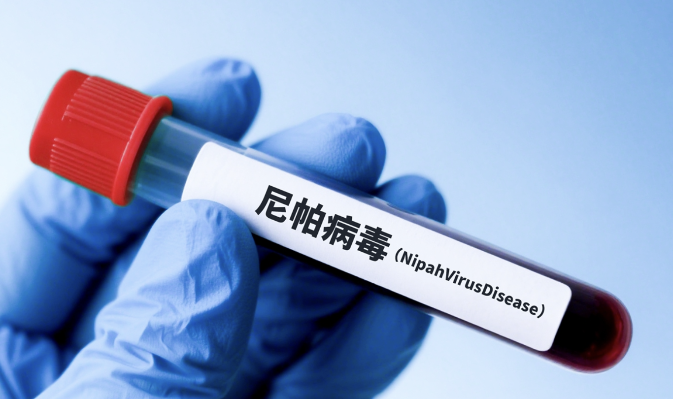 Các nhà khoa học Trung Quốc phát hiện thuốc kháng virus Nipah - Ảnh 1. Các nhà khoa học Trung Quốc phát hiện thuốc kháng virus Nipah - Ảnh 1.