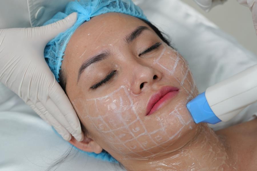 Top 7 công nghệ trẻ hóa da tiên tiến hiện nay - Ảnh 2. Top 7 công nghệ trẻ hóa da tiên tiến hiện nay - Ảnh 2.