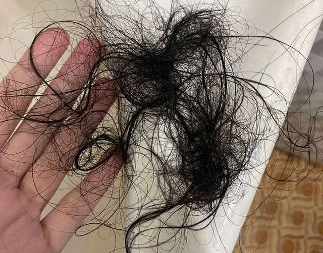 Bất Kể Nam Hay Nữ, Ăn Càng Nhiều 5 Món Này Tóc Càng Rụng Bất Kể Nam Hay Nữ, Ăn Càng Nhiều 5 Món Này Tóc Càng Rụng