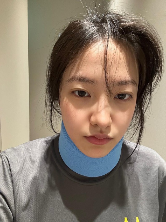 Nữ Idol Gãy Cổ Vì Tập Pilates- Ảnh 1. Nữ Idol Gãy Cổ Vì Tập Pilates- Ảnh 1.