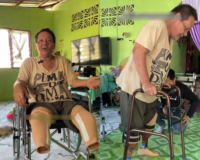 Đừng uống nước ngọt theo cách này: Người đàn ông phải cắt bỏ cả hai chân, nhiều tiền cũng trở nên vô nghĩa- Ảnh 1.