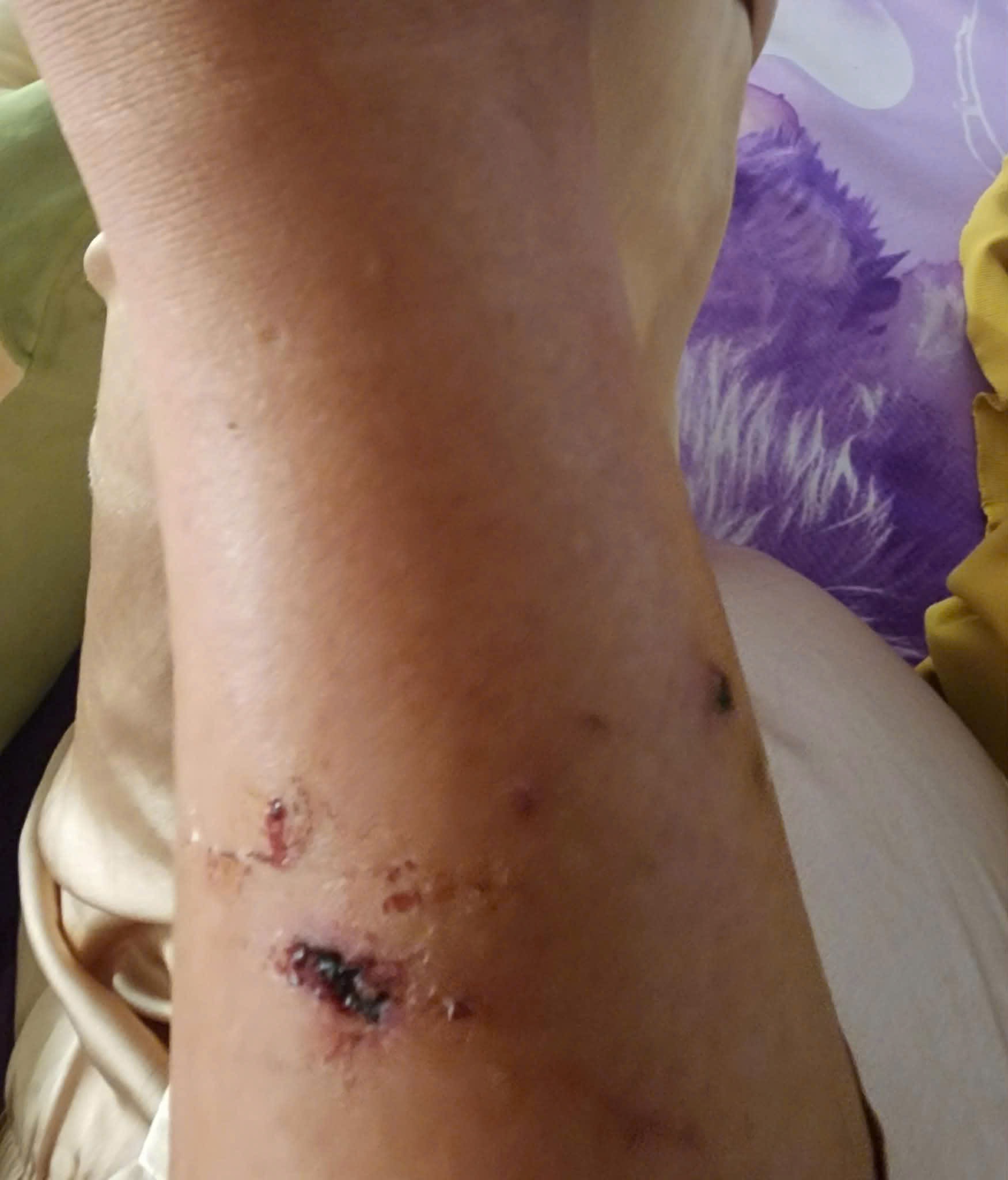 Khỉ tấn công người đi bộ tại TPHCM: Cảnh báo an toàn cho người dân - Ảnh 3. Khỉ tấn công người đi bộ tại TPHCM: Cảnh báo an toàn cho người dân - Ảnh 3.