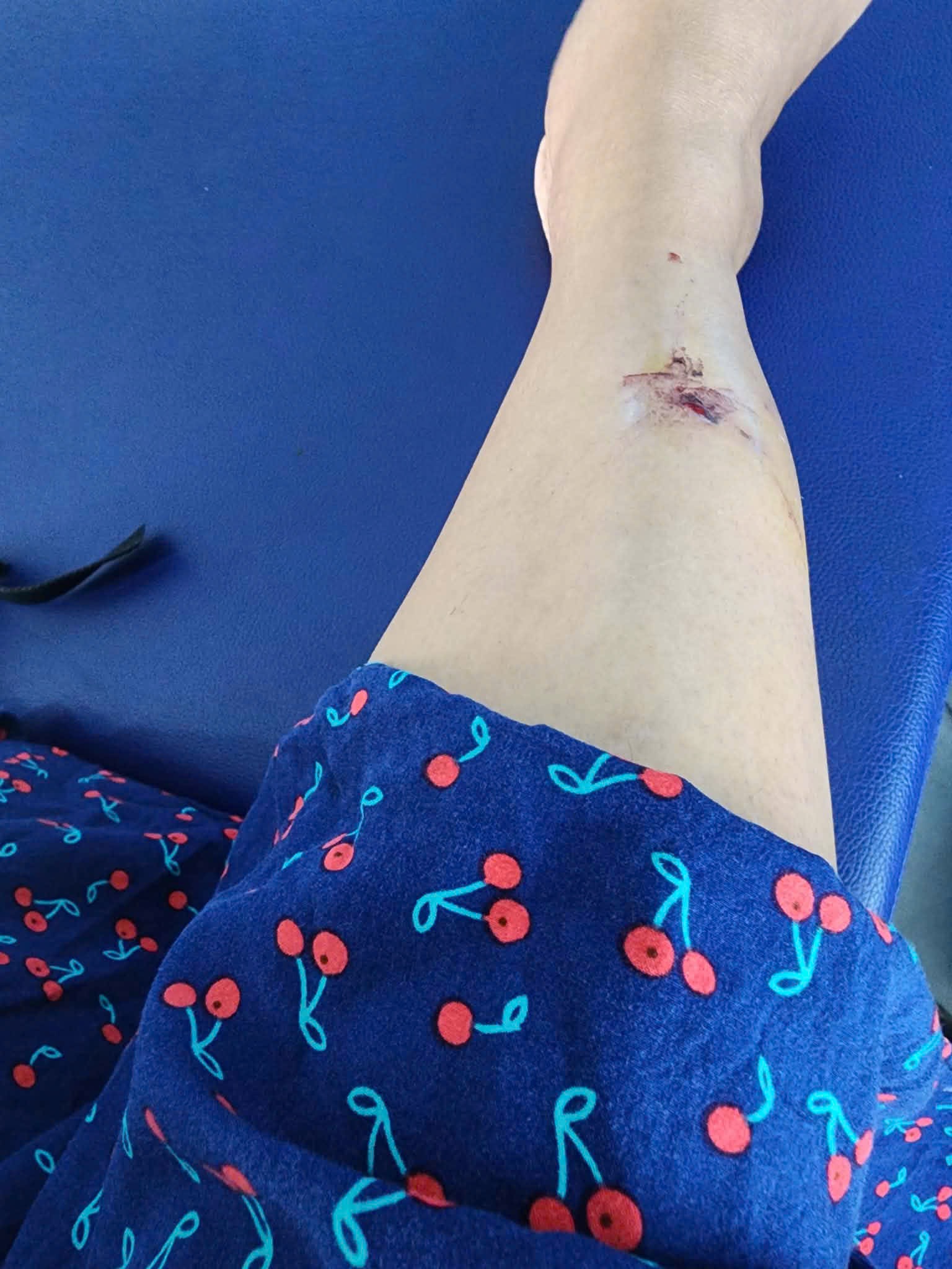 Khỉ tấn công người đi bộ tại TPHCM: Cảnh báo an toàn cho người dân - Ảnh 2. Khỉ tấn công người đi bộ tại TPHCM: Cảnh báo an toàn cho người dân - Ảnh 2.