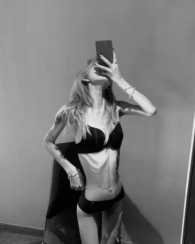 Phát sợ với cơ thể gầy trơ xương, héo mòn của con gái 