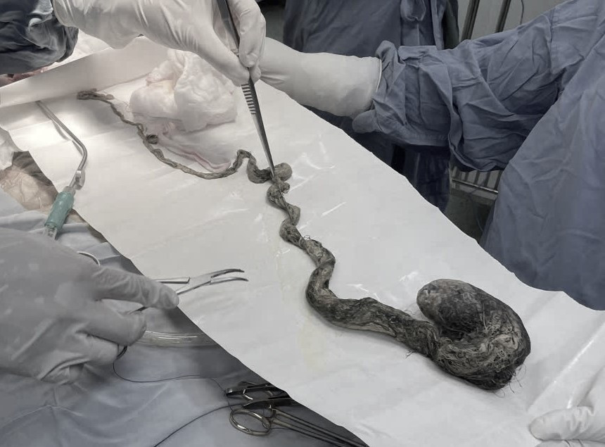 Toc2 1769902629477 1769902629670688802064