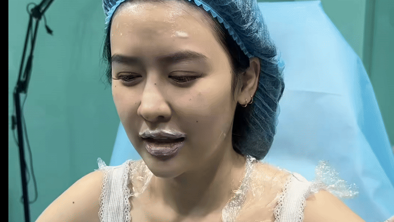 Quyên Qui tu sửa gương mặt - Ảnh 1. Quyên Qui tu sửa gương mặt - Ảnh 1.