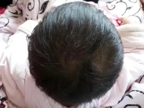 Theo quan niệm d&acirc;n gian những đứa trẻ "2 xo&aacute;y t&oacute;c" thường nghịch v&agrave; bướng, nhưng kh&ocirc;ng phải chỉ c&oacute; như vậy - Ảnh 4.