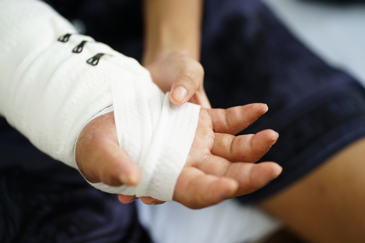 Gặp người mẹ trong ca gh&eacute;p nối b&agrave;n tay được &ldquo;nu&ocirc;i&rdquo; gần 2 th&aacute;ng dưới ch&acirc;n: &ldquo;Tết n&agrave;y với chị vậy l&agrave; trọn vẹn&rdquo;- Ảnh 7.