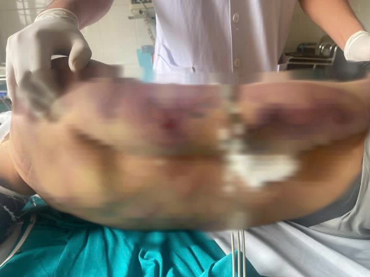 R&agrave; so&aacute;t hoạt động cơ sở Bảo trợ x&atilde; hội sau vụ học vi&ecirc;n tử vong tại Hải H&agrave; - Ảnh 2.