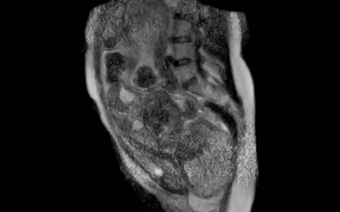 Người phụ nữ sinh con trong m&aacute;y chụp cộng hưởng từ- Ảnh 1.