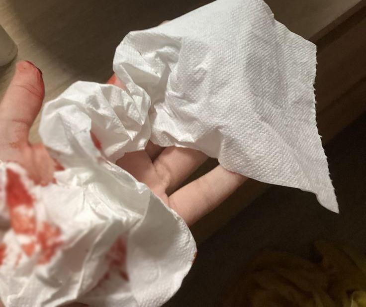 Nữ thư k&yacute; ngất xỉu khi đi vệ sinh, tưởng đột quỵ h&oacute;a ra su&yacute;t chết v&igrave; "bệnh kh&oacute; n&oacute;i" ở d&acirc;n văn ph&ograve;ng - Ảnh 2.