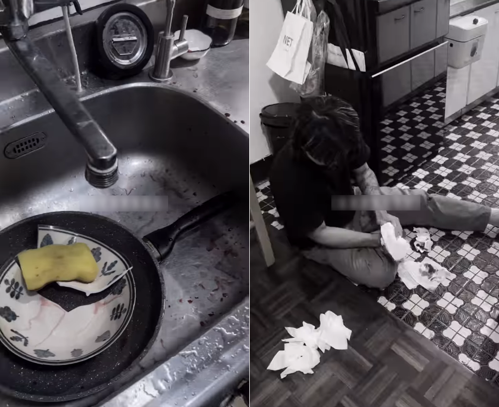 Rửa b&aacute;t, tay người đ&agrave;n &ocirc;ng chảy m&aacute;u xối xả, phải kh&acirc;u 4 mũi: B&aacute;c sĩ cảnh b&aacute;o th&oacute;i quen nhiều người mắc- Ảnh 1.