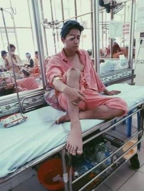 Nam ca sĩ điển trai từng vỡ xương g&ograve; m&aacute;, liệt nửa mặt: Lui về hậu trường suốt nhiều năm- Ảnh 2.
