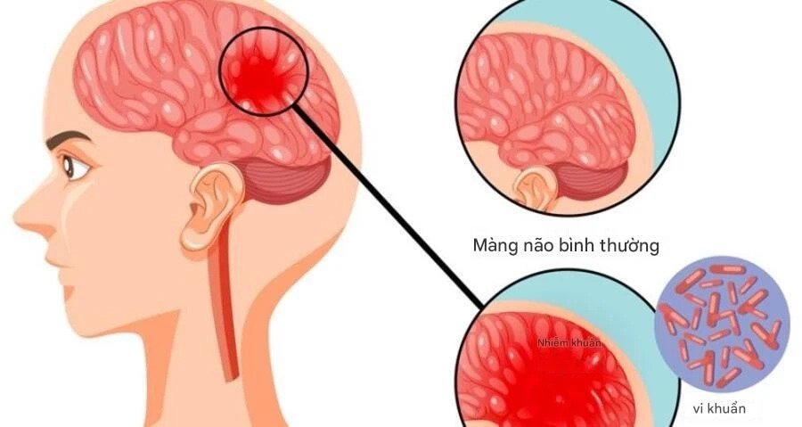 - Ảnh 1. - Ảnh 1.