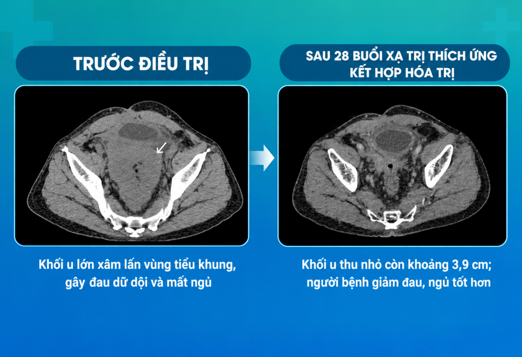 - Ảnh 1. - Ảnh 1.