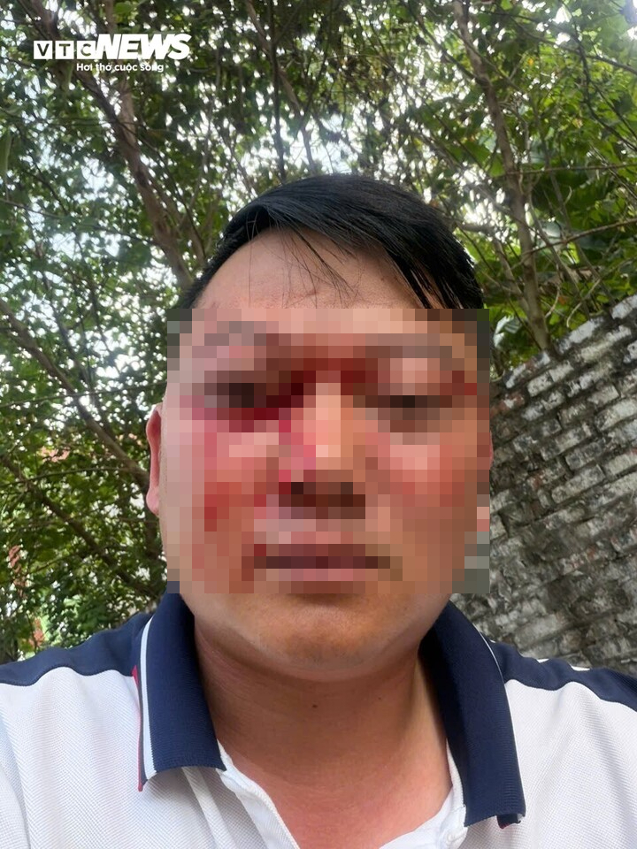 - Ảnh 1. - Ảnh 1.