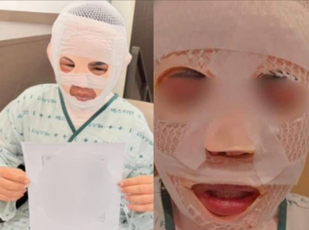 Chồng đổ nước s&ocirc;i l&ecirc;n mặt vợ đang ngủ v&igrave; sợ vợ quen người đ&agrave;n &ocirc;ng kh&aacute;c - Ảnh 1.