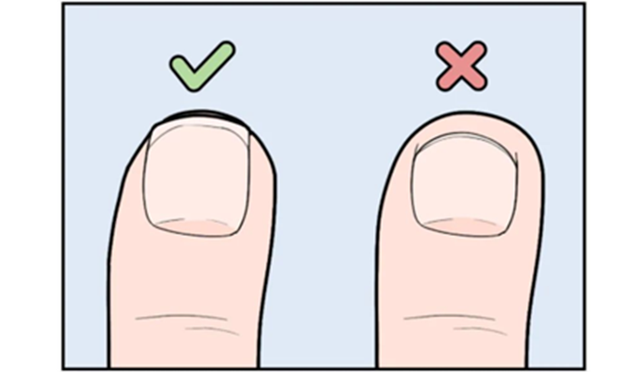 Nên Cắt Móng Tay Hình Tròn Hay Hình Vuông? Nhiều Người Thường Mắc Sai Lầm Ở 3 Chi Tiết Này - Ảnh 2.