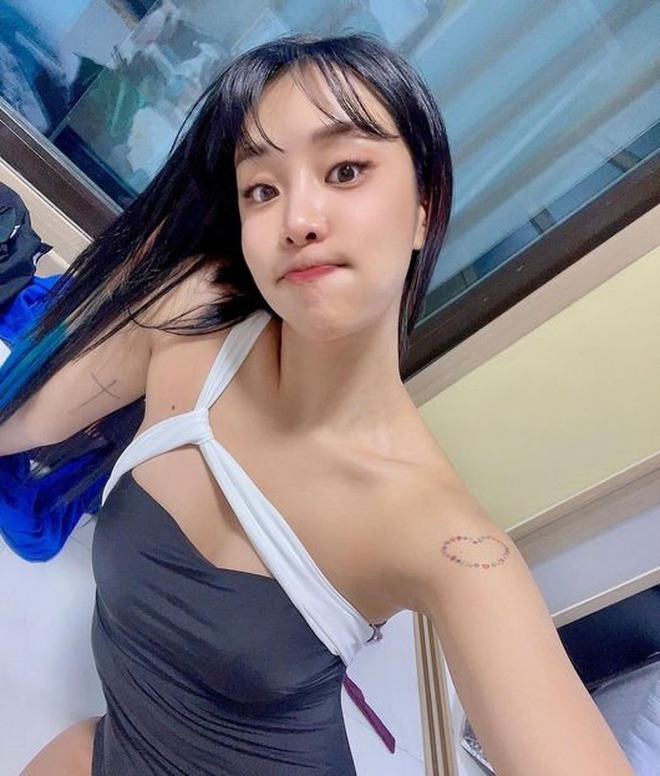 Trùng tu nhan sắc để ăn Tết, 1 sao nữ mặt mũi biến dạng, sưng phồng như bị 