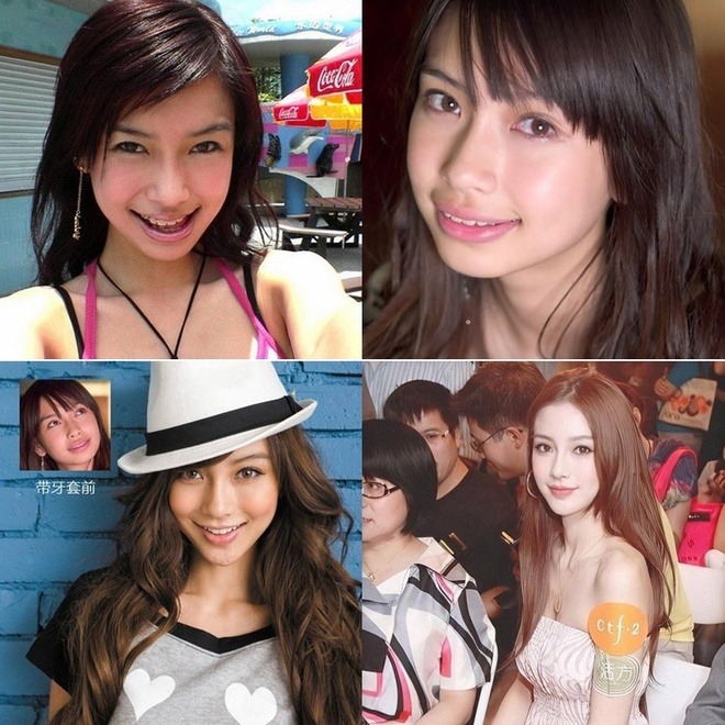 Quá khứ giấu kỹ của Angelababy bại lộ vào mùng 2 Tết- Ảnh 4.