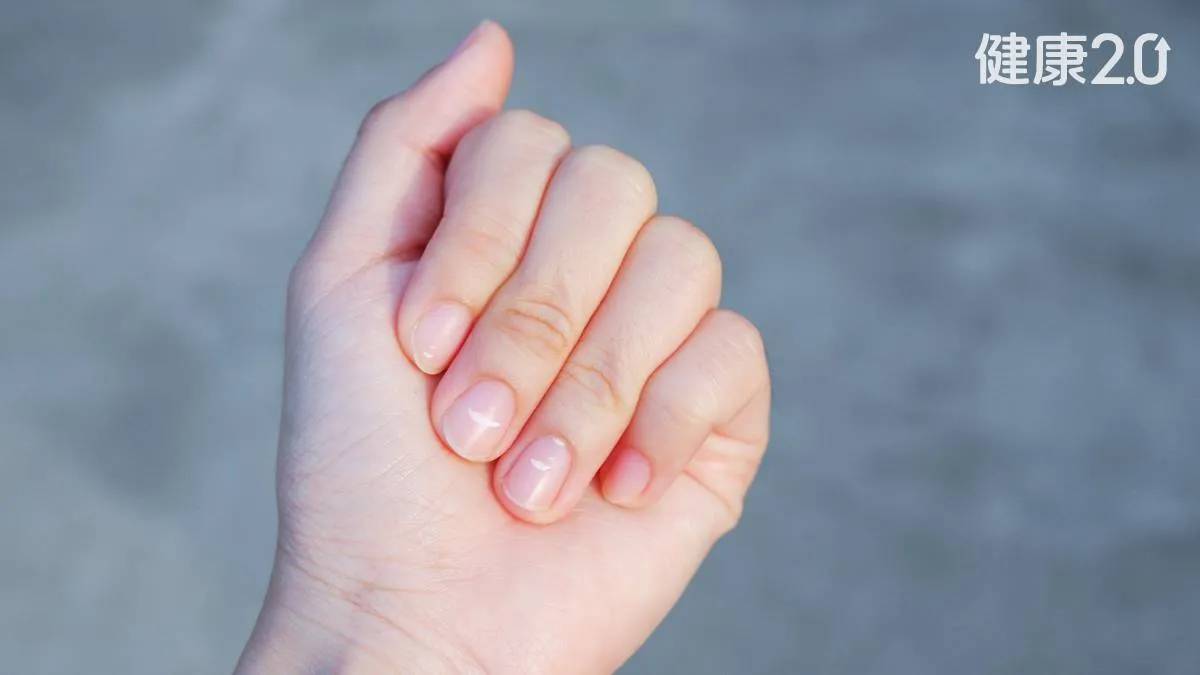 Bàn Tay Là Tín Hiệu Cảnh Báo Sức Khỏe: 1 Thay Đổi Có Thể Cho Thấy Bệnh Tiểu Đường Hoặc Xơ Gan- Ảnh 1.