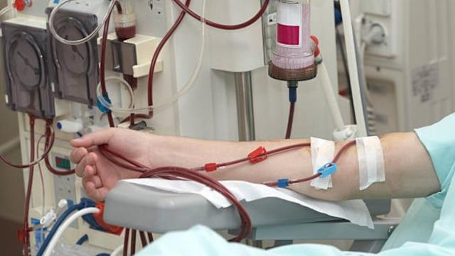 26 tuổi đã phải lọc máu cấp cứu: Bác sĩ cảnh báo 5 kiểu sống đang âm thầm hủy hoại thận của giới trẻ 19 26 tuổi đã phải lọc máu cấp cứu: Bác sĩ cảnh báo 5 kiểu sống đang âm thầm hủy hoại thận của giới trẻ - Ảnh 2.