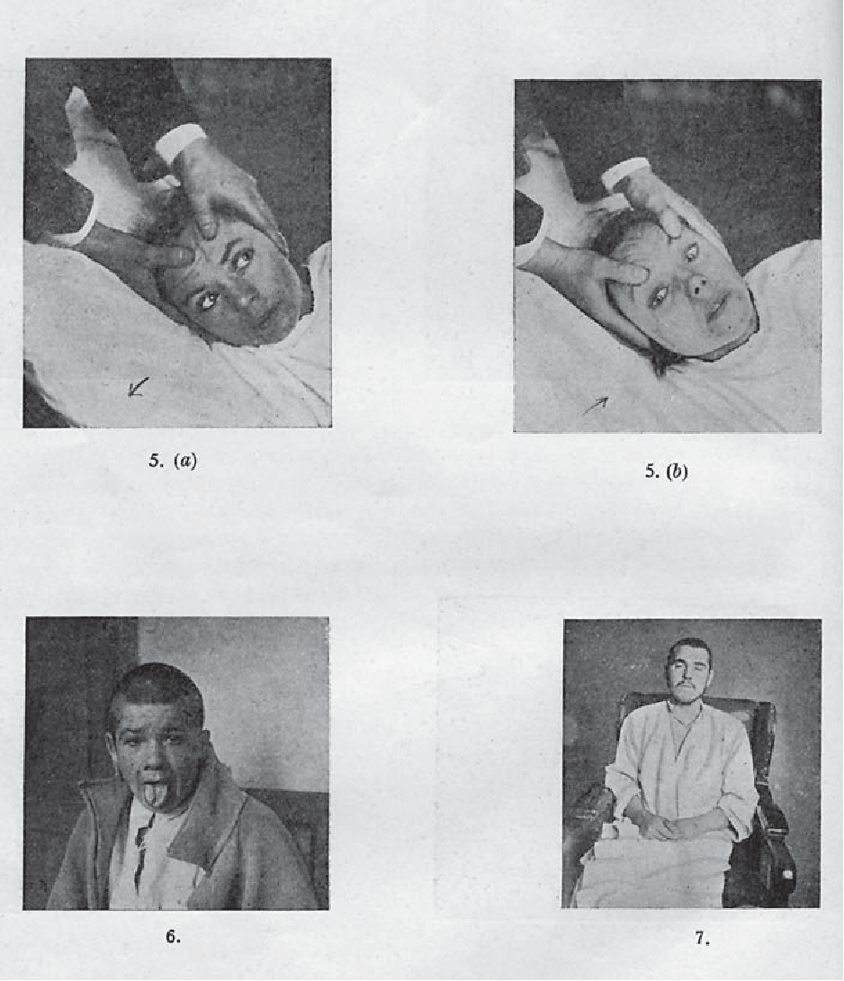 B&iacute; ẩn về căn bệnh cướp đi 500.000 sinh mạng rồi đột ngột biến mất kh&ocirc;ng một dấu vết - Ảnh 2.