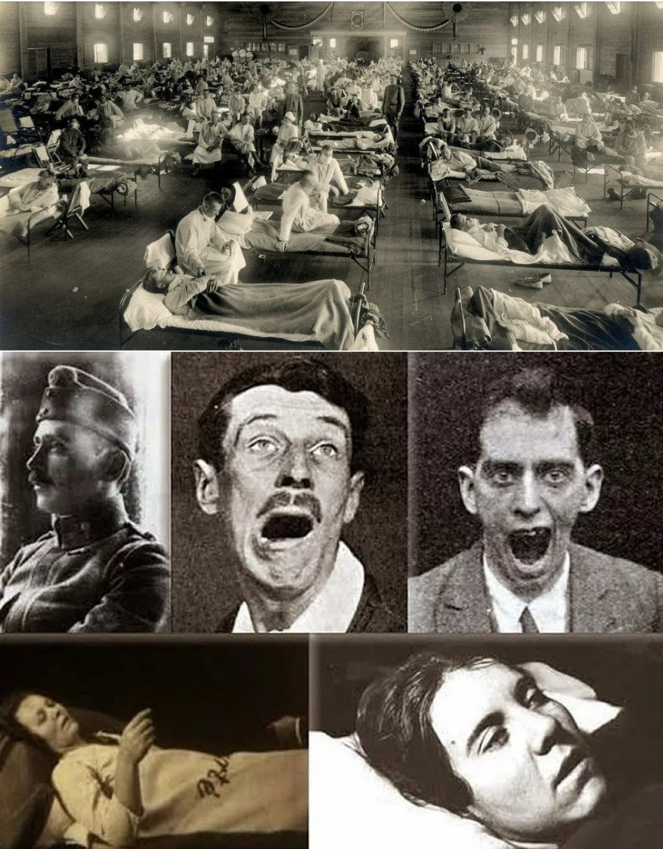 B&iacute; ẩn về căn bệnh cướp đi 500.000 sinh mạng rồi đột ngột biến mất kh&ocirc;ng một dấu vết - Ảnh 1.