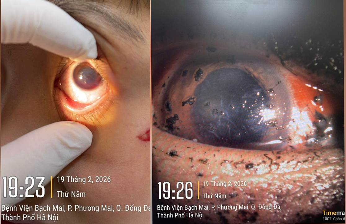 a1 1771681051314 17716810518861687480801