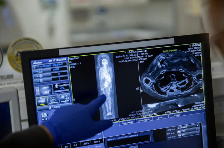 Công nghệ quét CT tiết lộ bí mật xác ướp Ai Cập hơn 2 . 000 Năm tuổi - Ảnh 2.