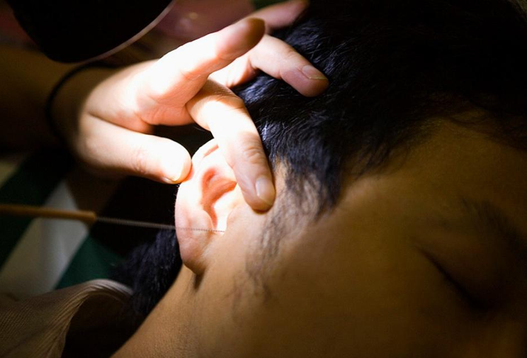 Người đàn ông 30 tuổi tai chảy dịch có mùi lạ vì thói quen nhiều người làm vài giờ mỗi ngày- Ảnh 2. Người đàn ông 30 tuổi tai chảy dịch có mùi lạ vì thói quen nhiều người làm vài giờ mỗi ngày- Ảnh 2.