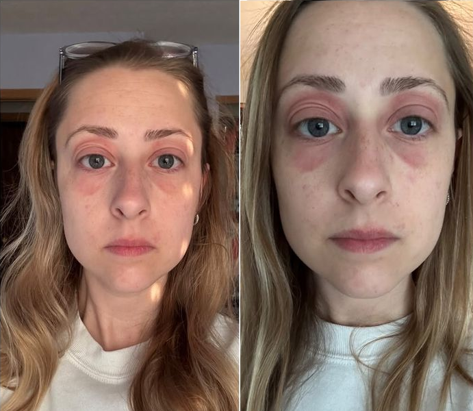 Bỏ 10 tỷ mua nh&agrave;, dọn v&agrave;o ở được v&agrave;i th&aacute;ng, người phụ nữ mắc phải căn bệnh lạ khiến cơ thể biến dạng - Ảnh 1.