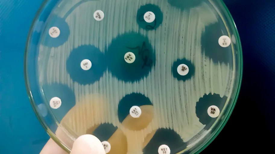 Một thứ b&iacute; ẩn bị "phong ấn" trong hang băng 5.000 năm vừa được giải ph&oacute;ng, c&oacute; thể tạo ra ph&eacute;p m&agrave;u cho nh&acirc;n loại - Ảnh 2.