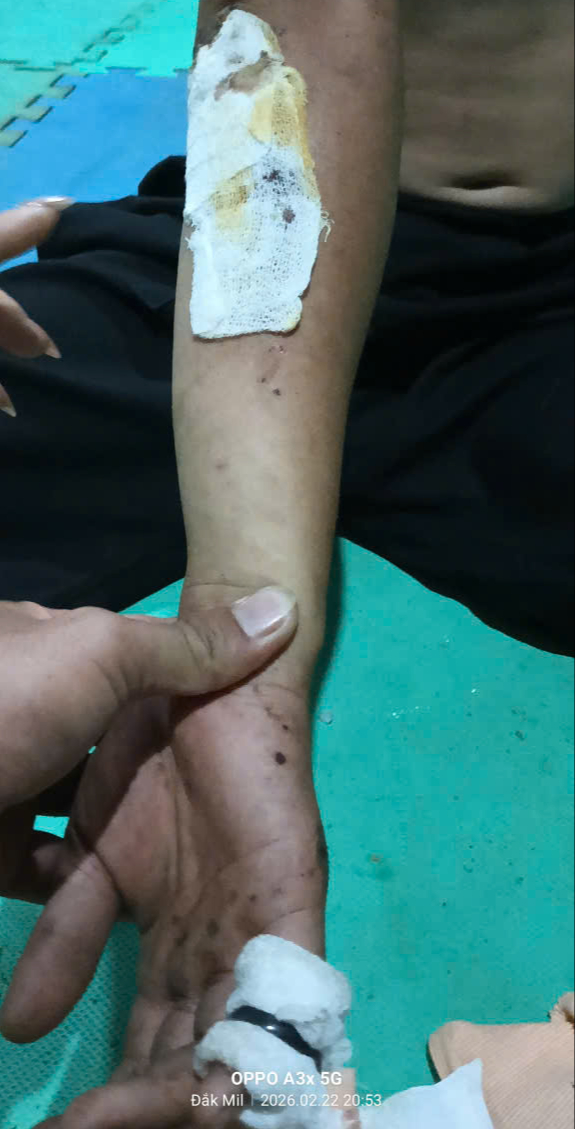 Va chạm xe bu&yacute;t với xe đạp điện khiến học sinh bị thương tại L&acirc;m Đồng - Ảnh 2.