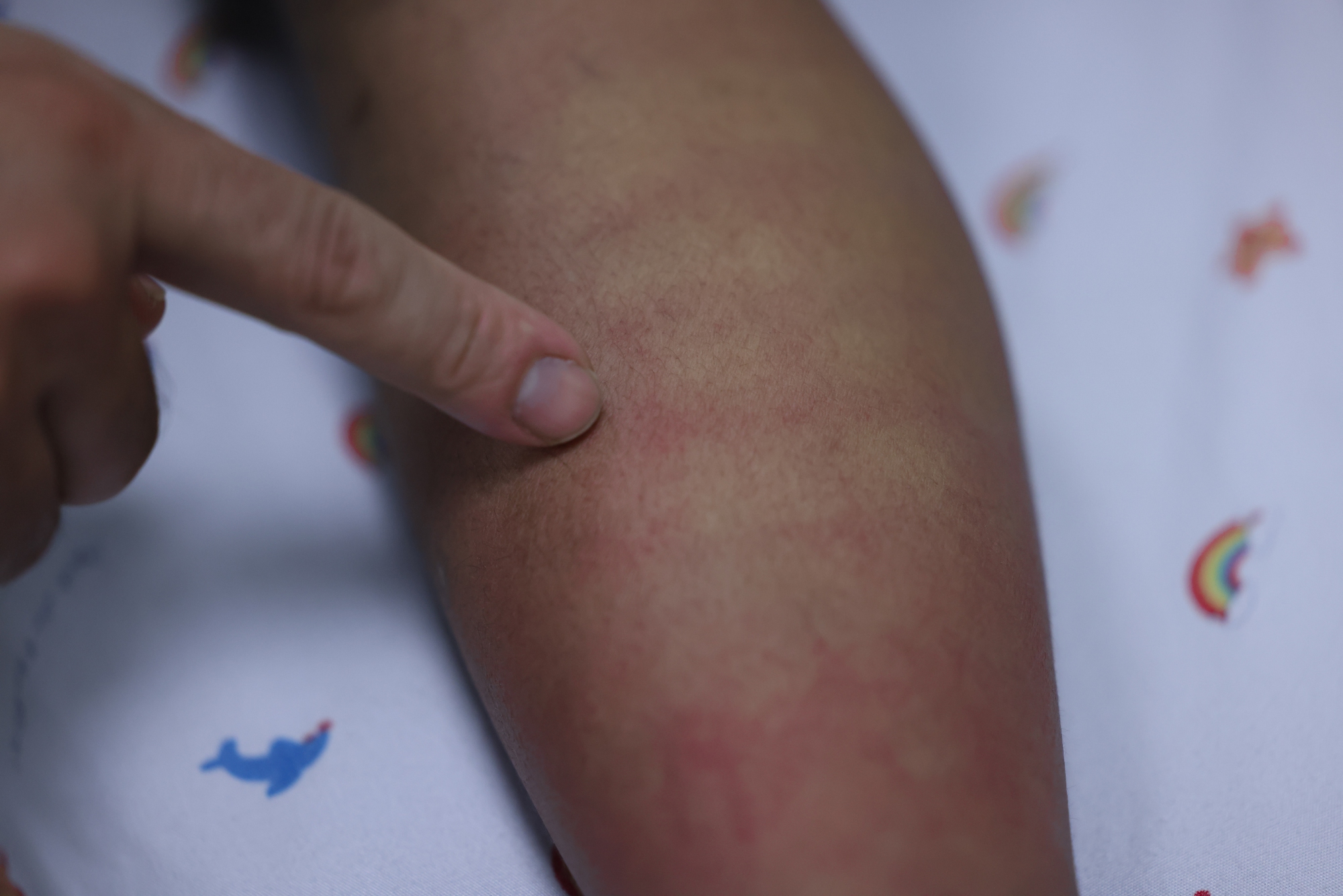 Một dịch bệnh b&aacute;o động đỏ sau Tết - Ảnh 4.