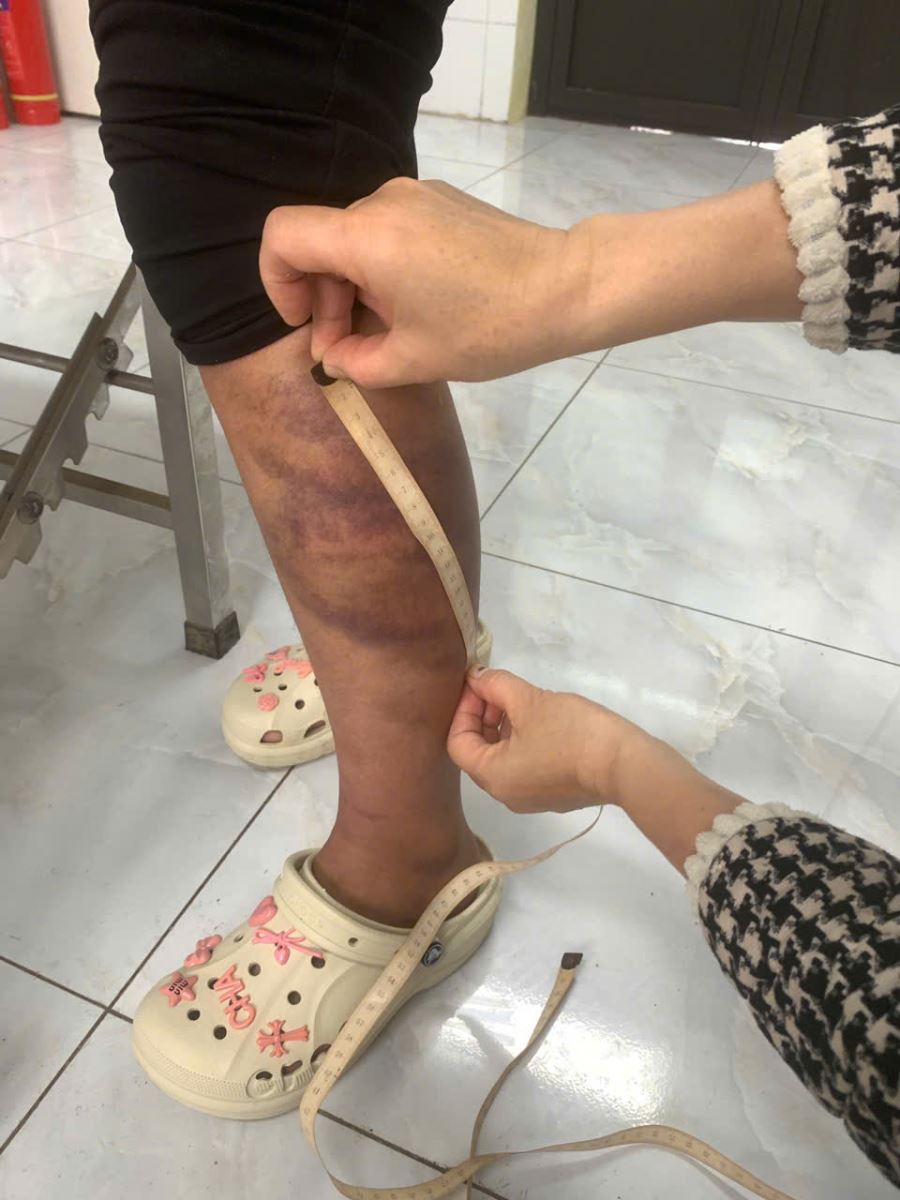 Người đ&agrave;n &ocirc;ng đ&aacute;nh đập con v&agrave; vợ mang thai trong ng&agrave;y Tết bị bắt giữ tại Bắc Ninh - Ảnh 2.