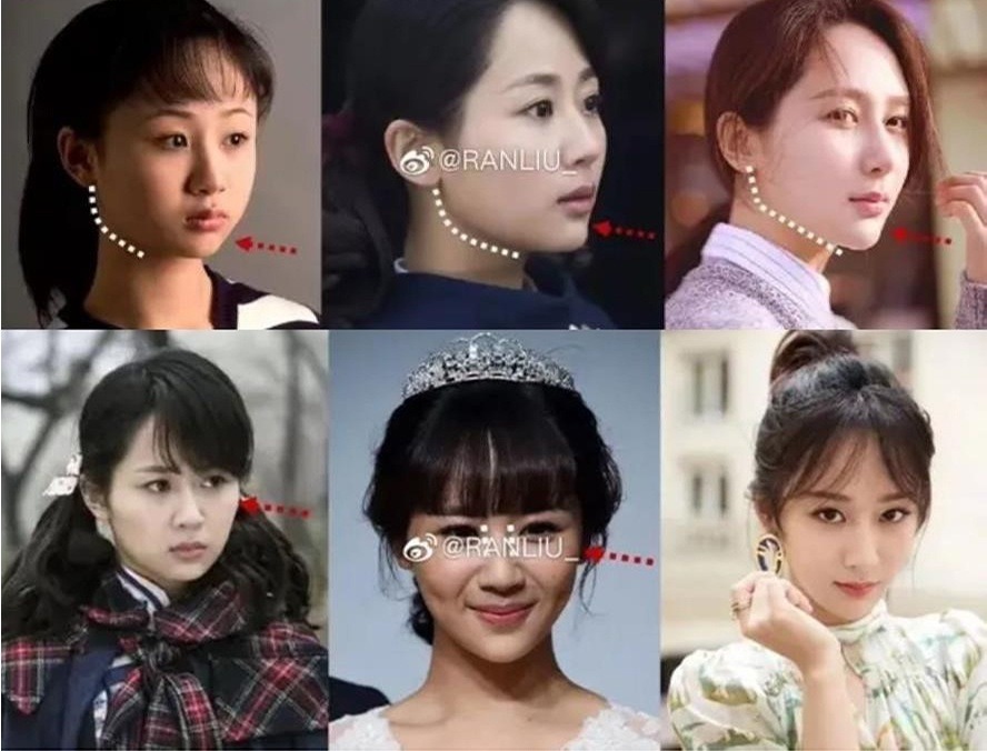 Bạn trai tin đồn kém 4 tuổi "đá" Lưu Diệc Phi để chạy theo "mỹ nhân 9X mặt búng ra silicon"? - Ảnh 8. Bạn trai tin đồn kém 4 tuổi "đá" Lưu Diệc Phi để chạy theo "mỹ nhân 9X mặt búng ra silicon"? - Ảnh 8.