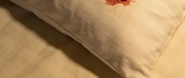 Nửa đ&ecirc;m tỉnh giấc, b&eacute; g&aacute;i lớp 7 kinh h&atilde;i ph&aacute;t hiện vết m&aacute;u loang tr&ecirc;n gối: Thủ phạm nằm ngay trong nh&agrave; - Ảnh 1.