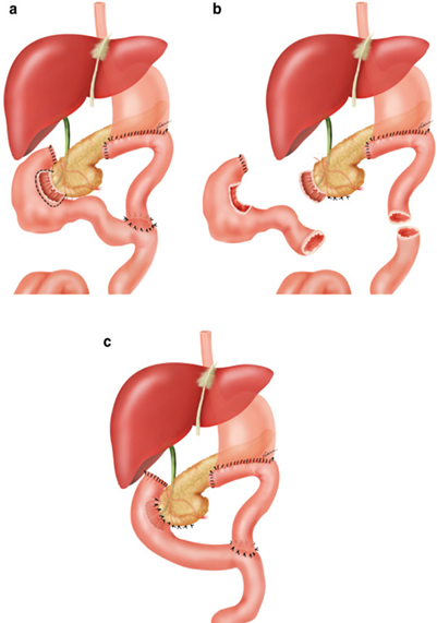 Lần đầu tại Việt Nam: B&aacute;c sĩ phẫu thuật th&agrave;nh c&ocirc;ng cho bệnh nh&acirc;n nước ngo&agrave;i mắc bệnh si&ecirc;u hiếm, 7 năm &ldquo;ăn v&agrave;o l&agrave; n&ocirc;n ra&rdquo; - Ảnh 2.