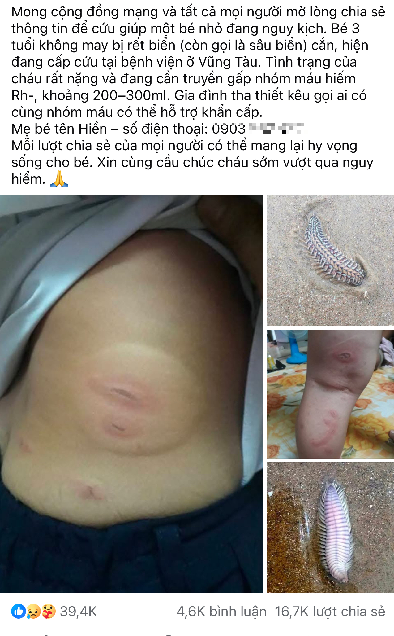 Thực hư thông tin bé 3 tuổi bị sâu biển cắn nguy kịch, gia đình tha thiết kêu gọi hỗ trợ máu hiếm - Ảnh 1.