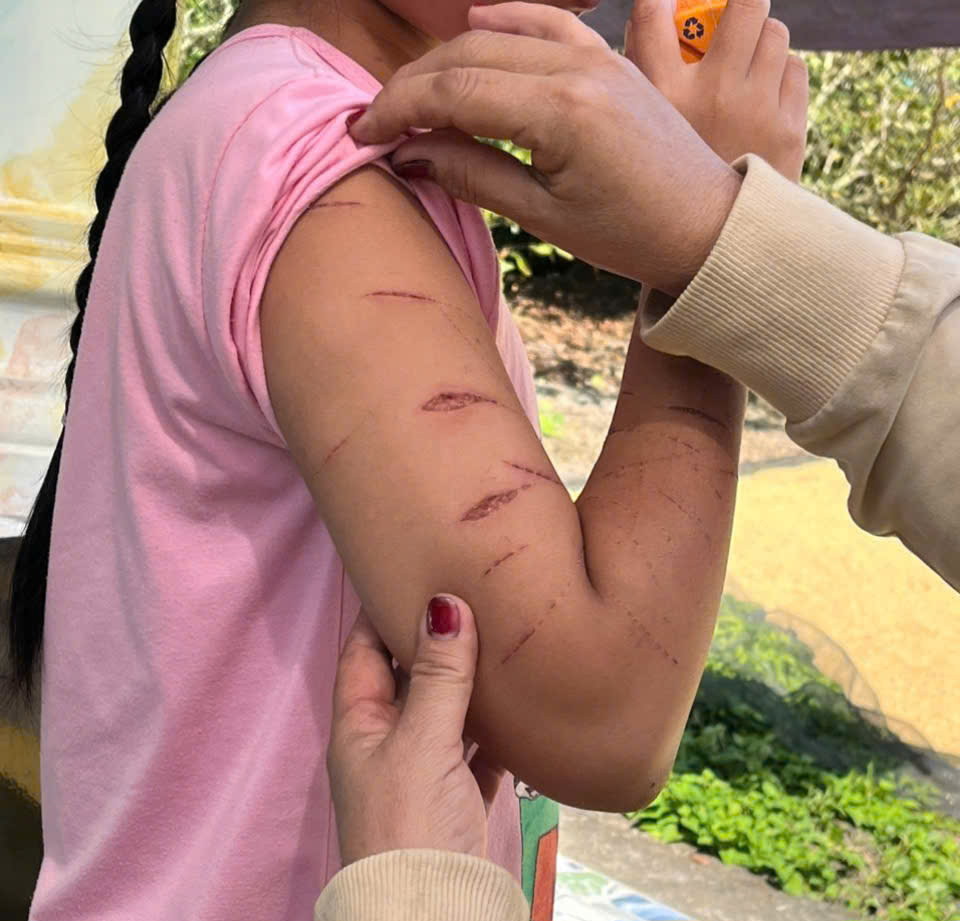 Nữ sinh Cà Mau bị chị bạn dì dùng dao cắt giấy gây thương tích nghiêm trọng - Ảnh 1.