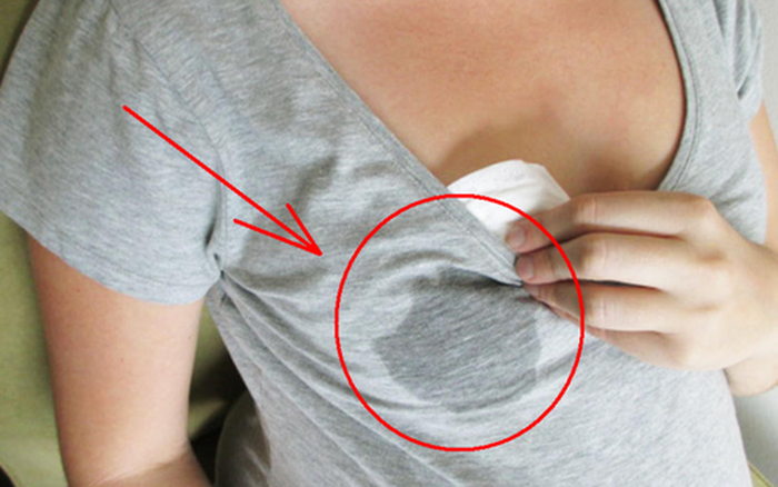 Mẹ vô tình phát hiện dịch màu vàng trên áo lót bé gái 13 tuổi, kết quả siêu âm gây sốc vì…- Ảnh 3.