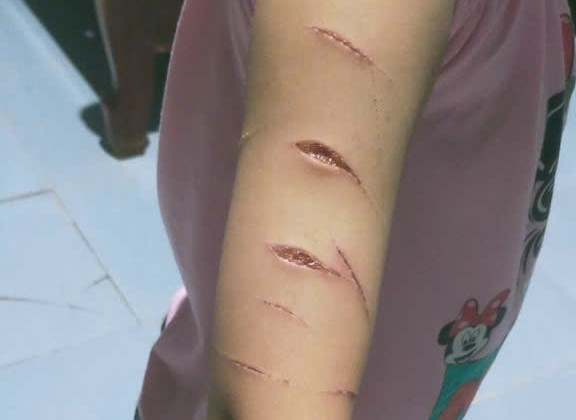 Chủ Tịch Cà Mau Chỉ Đạo 'Nóng', Giao Công An Vào Cuộc Vụ Học Sinh Bị Rạch Tay,- Ảnh 1.